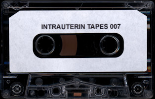 intrauterintapes007mca